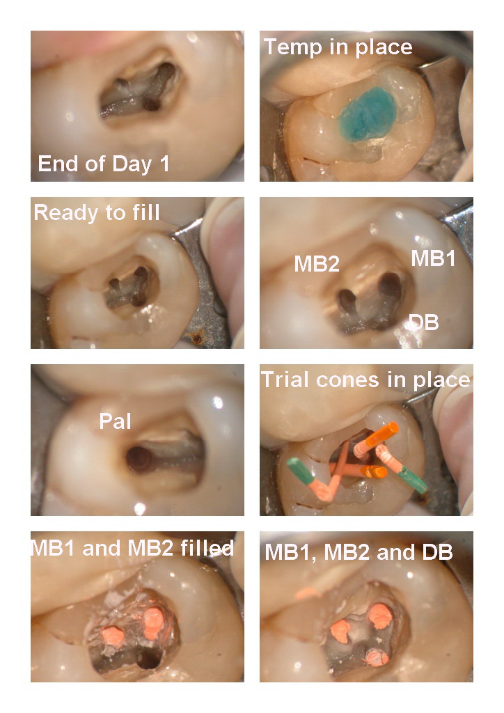 KW endo pg 2.jpg